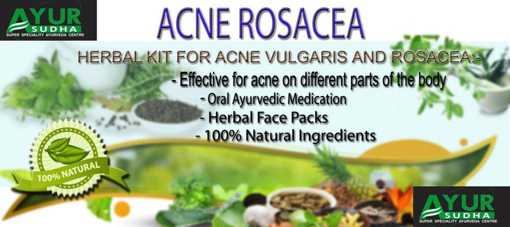 Acne Rosacea
Acne Rosacea treatment
Acne Rosacea treatment in ayurveda