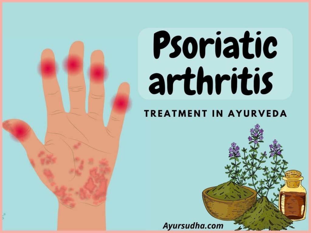 Psoriatic arthritis treatment in Ayurveda