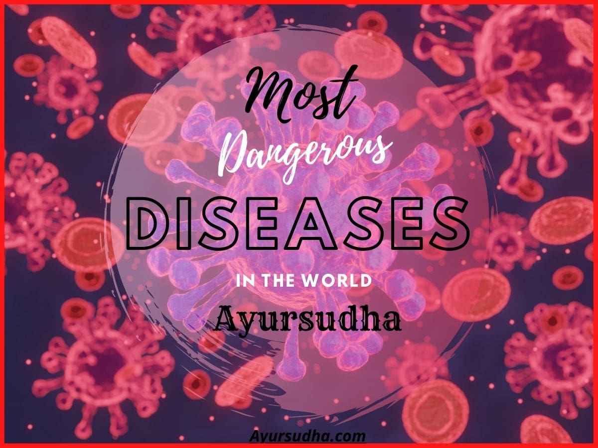 most dangerous diseases in the world