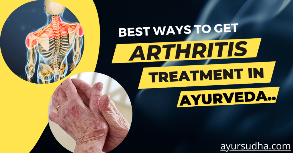 arthritis treatment in ayurveda