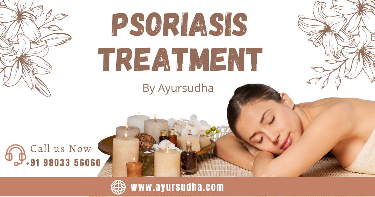 ayurvedic psoriasis treatment